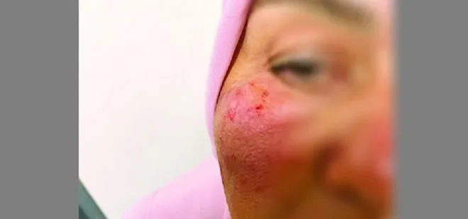 Havaalanı görevlisi yaşlı kadını darp etti