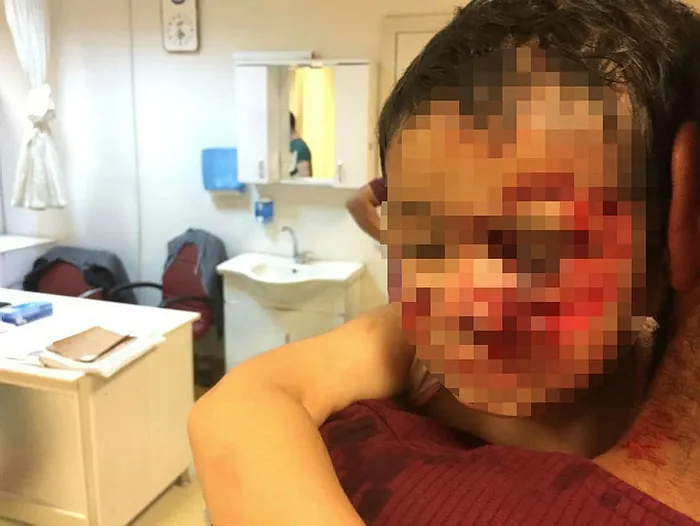 Şanlıurfa'da sokakta dehşet! 6 çocuk kanlar içerisinde kaldı, 3'ünün durumu ağır - 4