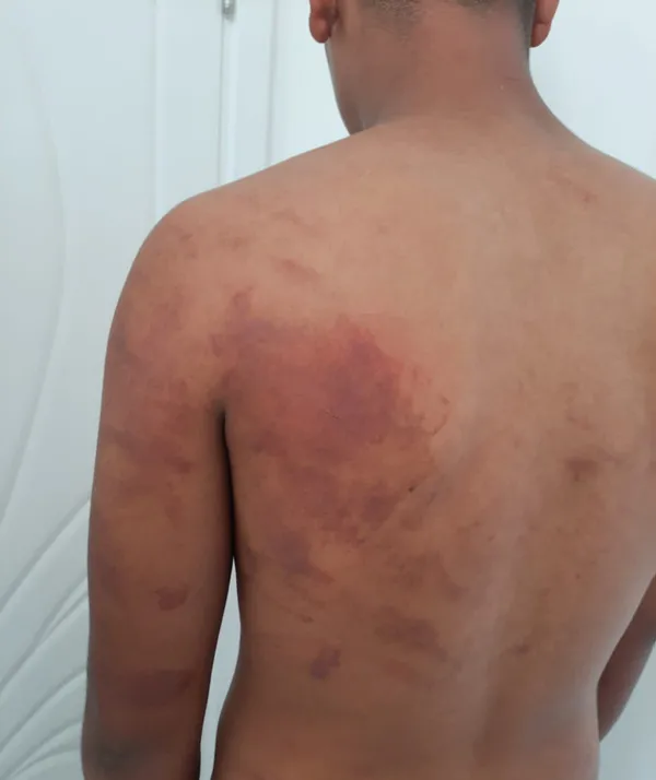 1692952198811.jpg Ailesi tarafından ahıra kilitlenen çocuk dehşeti yaşadı: Hayvan kancasıyla bağlayıp üzerine idrarını yaptılar - 6