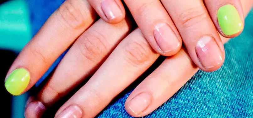 Tırnakların gösterdiği hastalık belirtileri! Uzmanlardan tırnak uyarısı