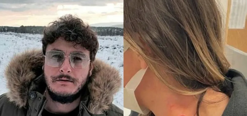 Son dakika: Bodrum’daki skandalda yeni gelişme! Trafikte kadını darp eden CHP’li yönetici Mehmet Engin Yıldızhan gözaltına alındı