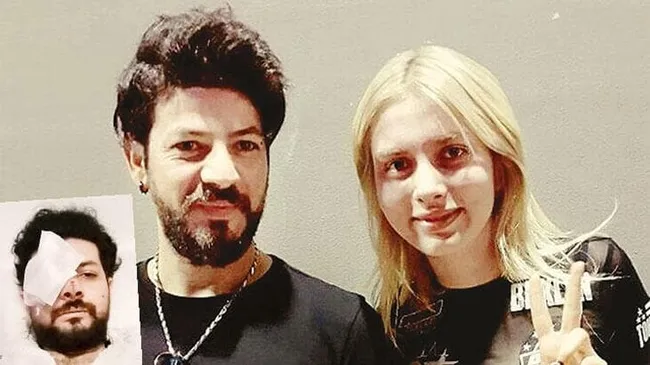 Son dakika: Genç şarkıcı Şahan Dinç maganda kurşunuyla gözünü kaybetti - 1