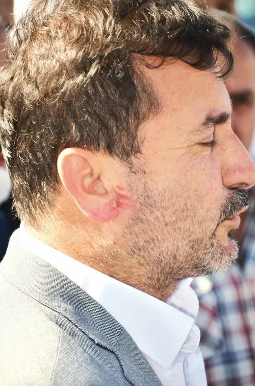 İYİ Parti'deki dayak skandalının mağdurları konuştu: Torunum yaşındaki çocuklardan sopa yedim! - 1