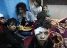 Gazze’deki birçok çocuğun uzuvları kesildi