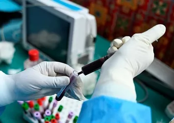 Dikkat öldürücü! Nezleye benziyor sakın hafife almayın