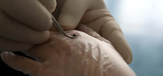 Adıyaman'da kadının kulağını kene ısırdı