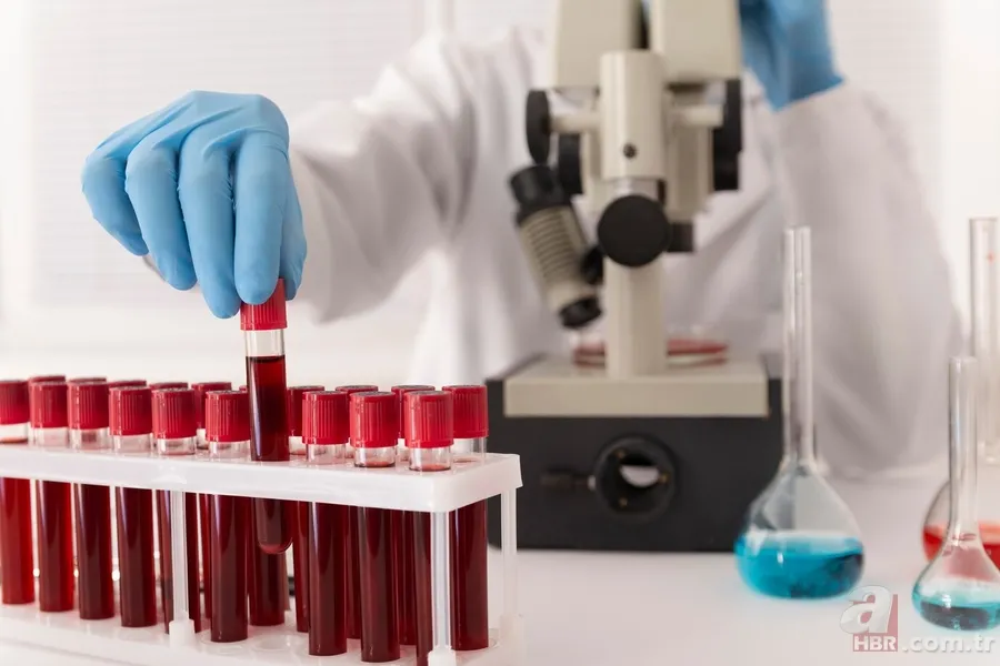 Bu kan grubuna sahip olanlar zeka küpü: Ama kötü yönleri var 1