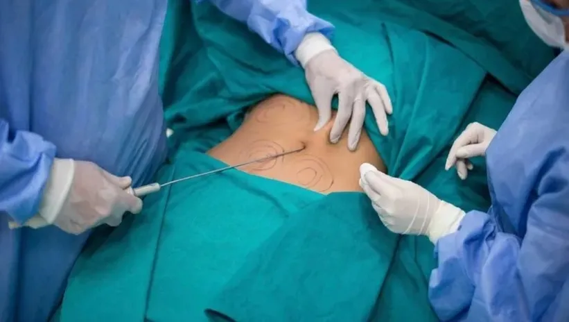 Estetik sevdası kabusu oldu! Kliniğe giden genç kadın ölümden döndü