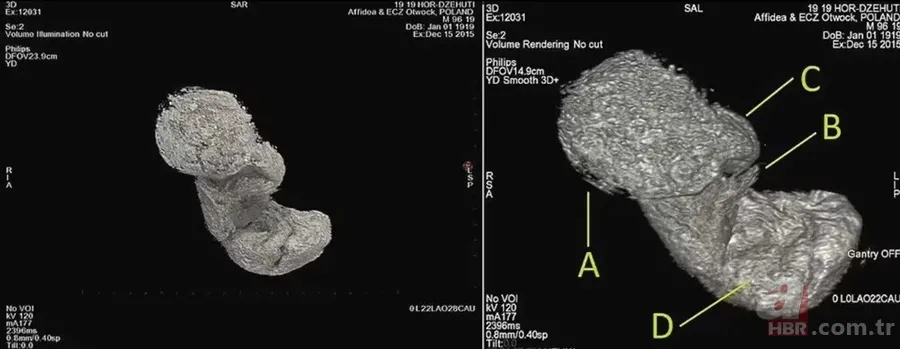 Doğmamış çocuğuyla mumyalandı: 2 bin yıl nasıl bozulmadan kaldı? "Gerçek bir insanlık trajedisi" 9