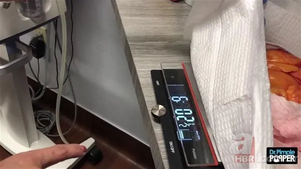 30 yıl boyunca baş ağrısıyla yaşadı! Nedeni şoke etti... 139