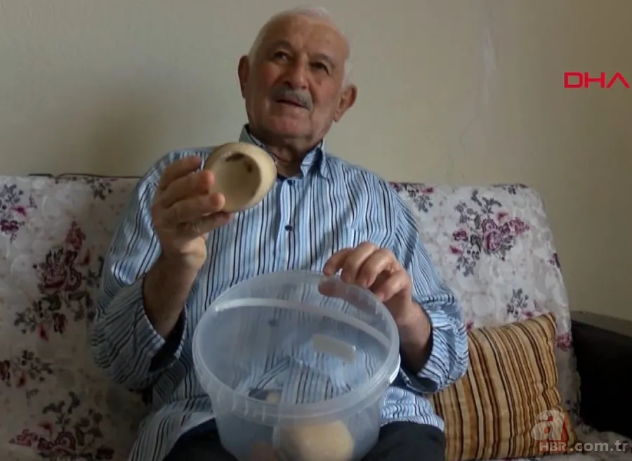 Karın bölgesinde şişlik ve halsizlik şikayetiyle doktora gitti! Karnından çıkanlar şoke etti 24