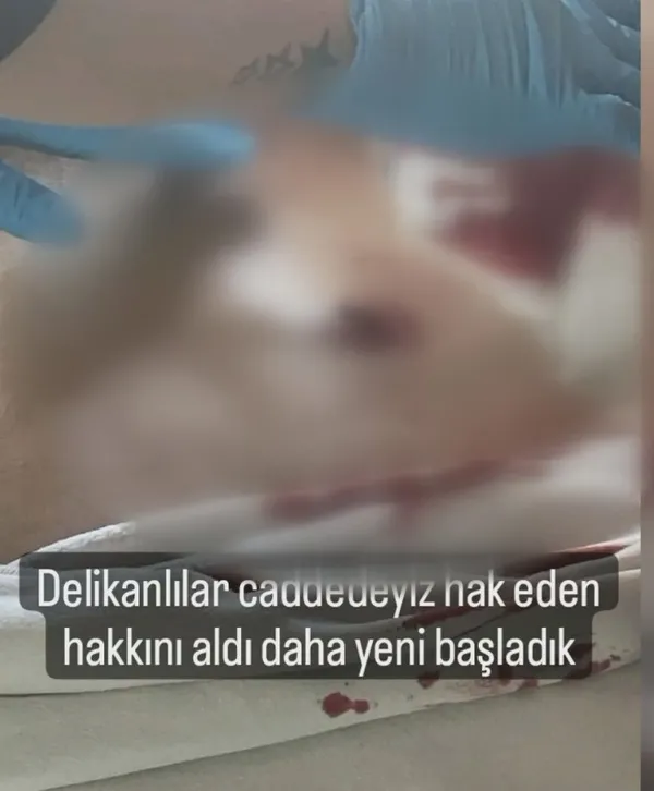 ankarada-17-yasindaki-genc-dehset-sacti-okul-arkadasini-bicakladi-1666175609979.jpg Ankara’da 17 yaşındaki genç dehşet saçtı! Okul arkadaşını bıçakladı - 5