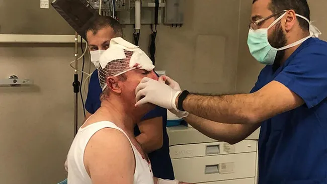 Gelecek Partisi Genel Başkan Yardımcısı Selçuk Özdağ’a saldırı anının görüntüsü ortaya çıktı - 3