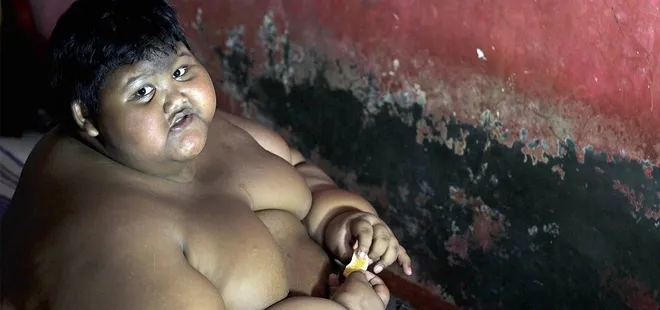 10 yaşında 190 kilo!