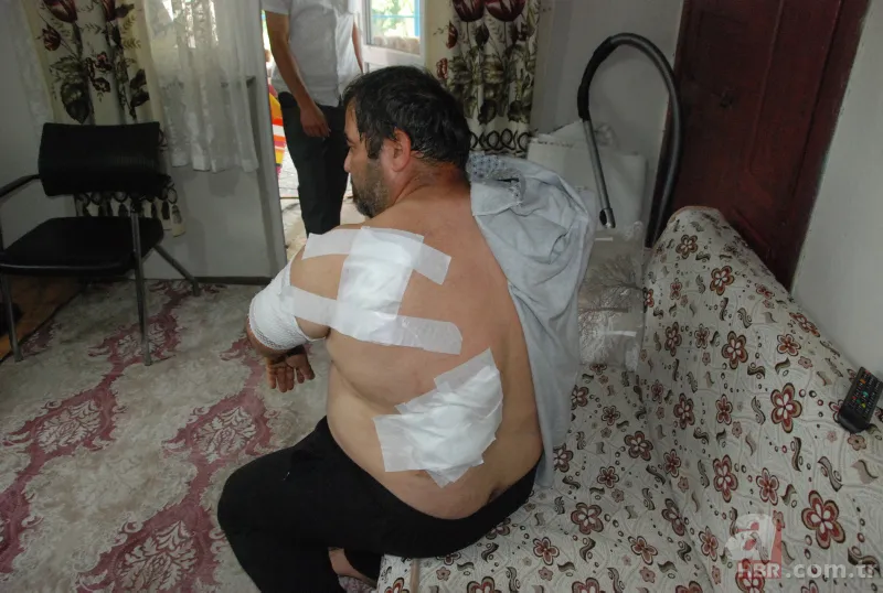 Bartın'da ayı saldırısı! 65 dikiş atıldı: Öldüğümü sanıp bıraktı 5