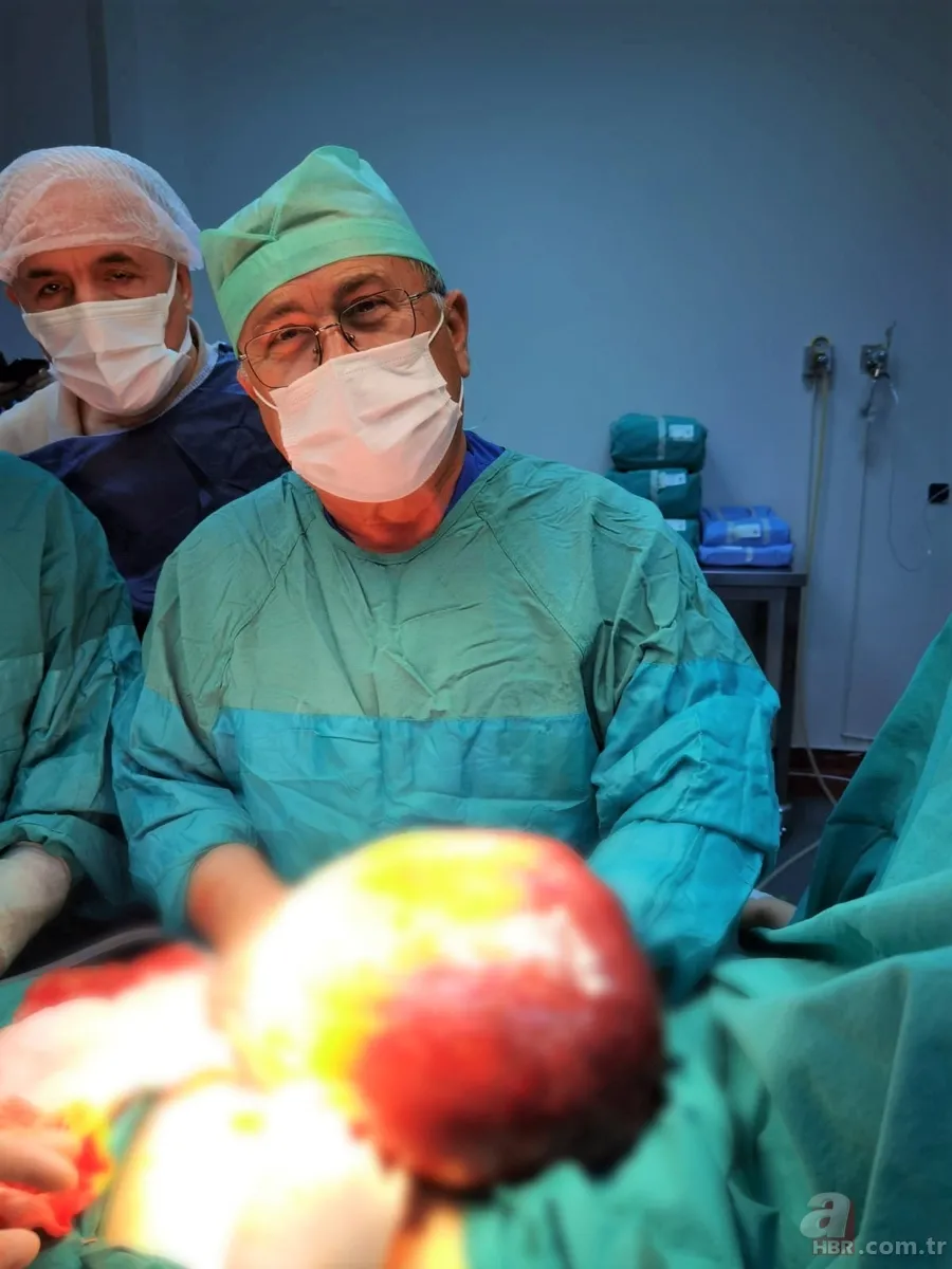 Amasya’da 22 yaşındaki genç kız karın ağrısı şikayetiyle hastaneye gitti! Gerçek şoke etti: Tam 5 kilo 3