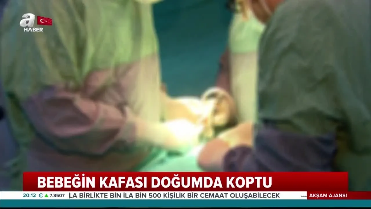 ankara da korkunc olay bebegin kafasi dogumda koptu a haber en son haberler