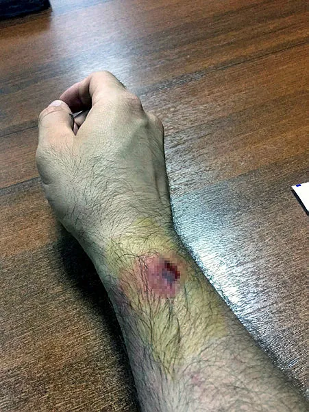Adana'da kumar oynayanlara şok baskın! Paraları almak için polisi ısırdı - 1