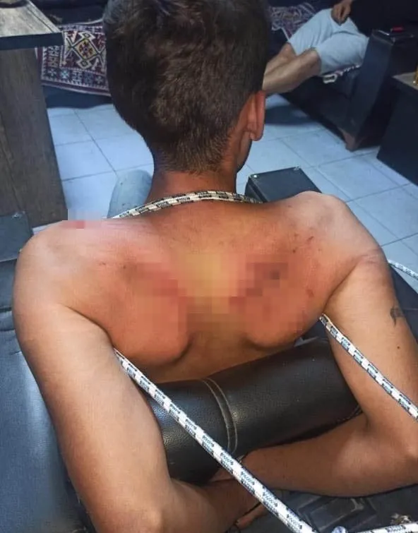 1721134266452.jpg Kerpetenle dişlerini söküp hamamböceği yedirdiler! Antalya'da kan donduran işkence: 4 yıldır kabuslarla uyanıyor - 5