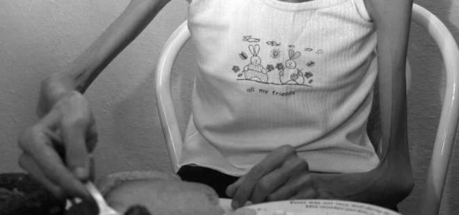 Kilo kaybı değil ruhsal çöküş: Anoreksiya