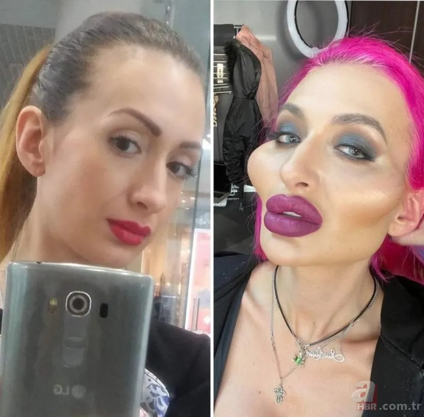 Fatih’te estetik yaptıran Bulgar modelin hayatı kabusa döndü! ‘Örümcek ağı’ operasyonu bakın ne hale getirdi? 24