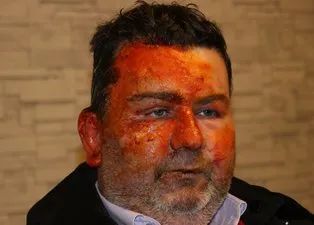 Uyurken hayatı altüst oldu! Kardeşinin yüzüğünü yaktığını söyledi: Ne iyi yaptım, seni yaktım