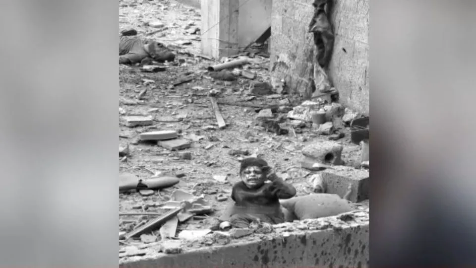 Gazze’de sessiz çığlık! Kanlar içindeki çocuk katliamın sembolü oldu