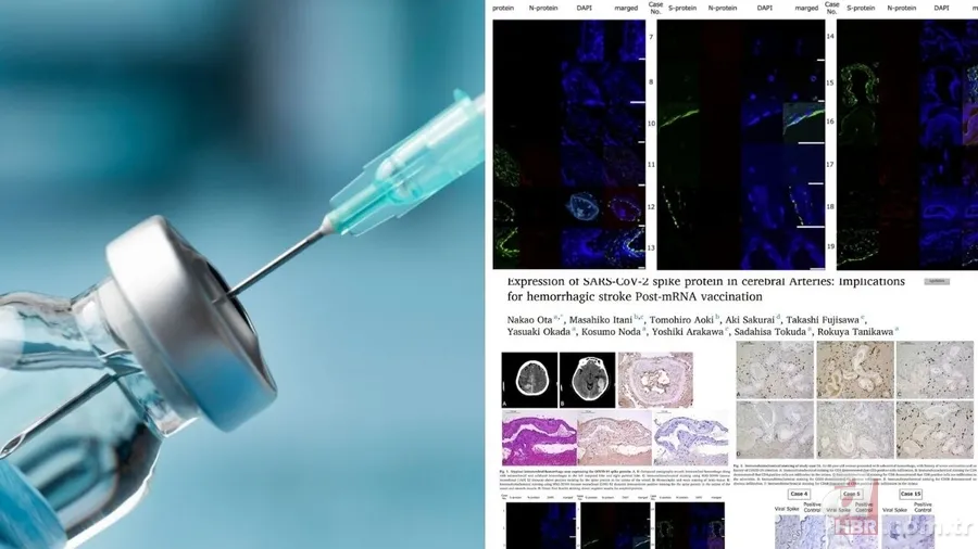 Felç riski COVID-19 aşısıyla artıyor mu? 100 binden fazla kişide görüldü: 17 ay hücrelerde birikerek... 1