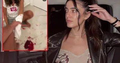 İrem Ay'dan şok ABD iddiası İşkence görüntüleri gündem olmuştu
