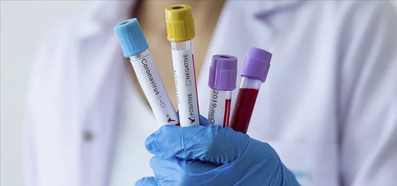 Son dakika: KKTC'de koronavirüs şüphelisinin tahlil sonucu açıklandı