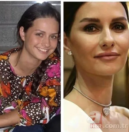 mustafa sandal dan ayrilan emina jahovic in estetik masrafi dudak ucuklatti