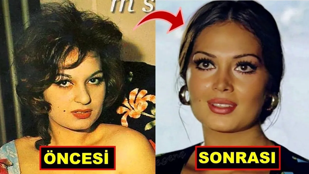 melike ipek yalova estetiksiz hali