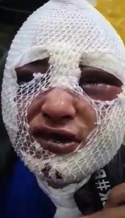 eski-sozlusunu-darp-etti-tecavuz-etti-basindan-asagi-kizgin-yag-doktu-serbest-birakildi-1646830748966.jpg Eski sözlüsünü darp etti, tecavüz etti, başından aşağı kızgın yağ döktü: Serbest bırakıldı - 2