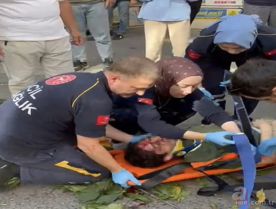 Ünlü oyuncu İbrahim Yıldız'ın üzerine ağaç düştü: Yaşam mücadelesi veriyor | Kaza anı ortaya çıktı 2