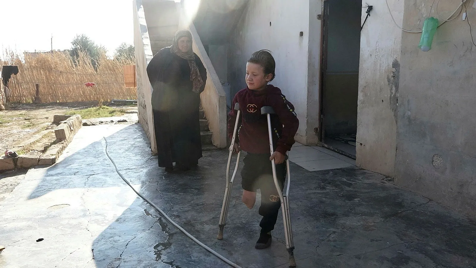 Türkiye'den engellilerin yüzünü protez tedavisiyle güldürüyor