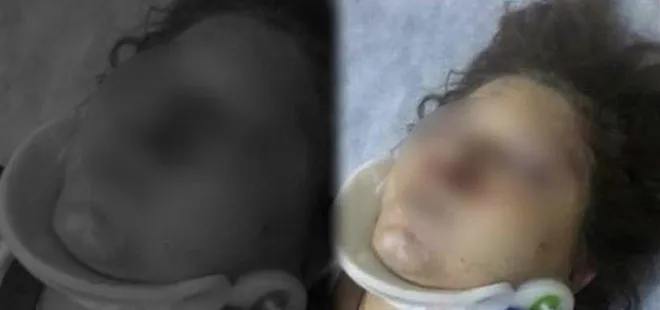 Çığlıkları duyan komşuları yardıma yetişti