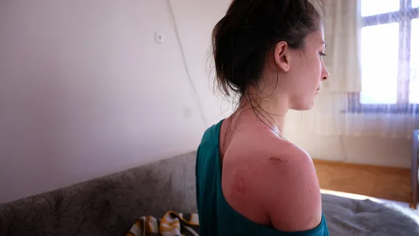 1611993855053.jpg Kocası kaynar suyla haşlamıştı! Rukiye Ay'ın sözleri yürek dağladı - 9