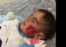 Sokakta dehşet! Kanlar içerisinde kaldılar