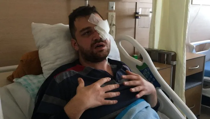 Konya'da korkunç olay! Avukatı gözünden bıçakladı