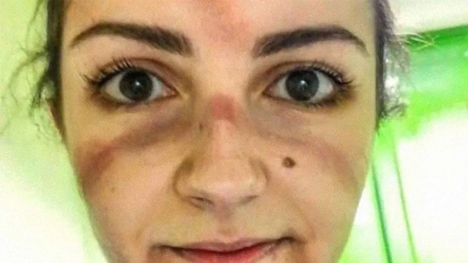 Coronavirüs ile mücadele eden sağlık çalışanlarının fedakarlık izleri