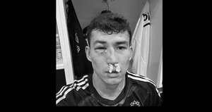 Beşiktaş’ta korkutan sakatlık!