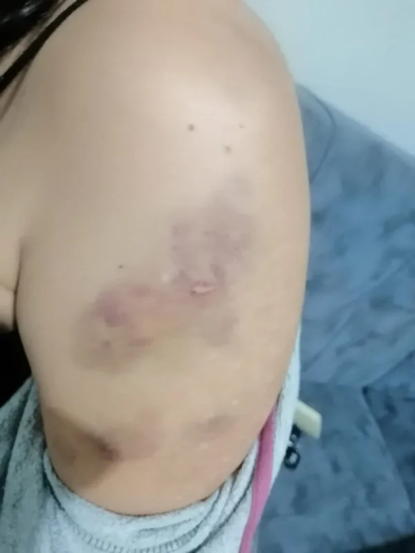 1612849031572.jpg İzmir'de ev kirasını geciktiren kadına ev sahibi 6 kişiyle saldırdı! Darp anı kameralara yansıdı - 1
