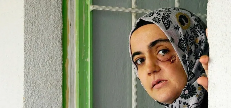 FETÖ'cü Ayşe Özdoğan planı çöktü! Tutanakla kayda alındı! Tedaviyi kendi kabul etmemiş