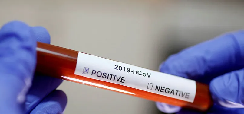 Aşkın Nur Yengi konseri COVID-19 nedeniyle iptal edildi