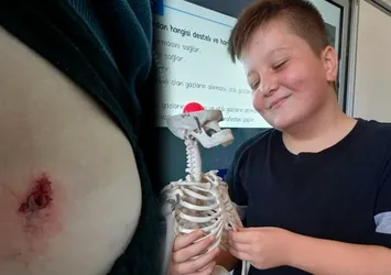 Denizli'de korkunç olay! Yorgun mermi 12 yaşındaki çocuğa kabusu yaşattı