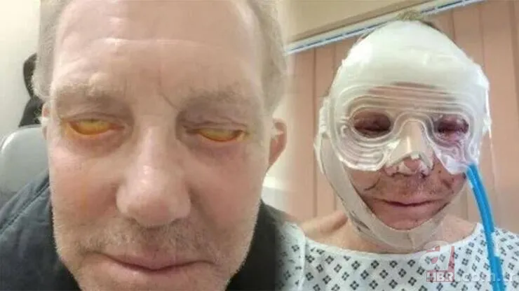 3 senedir gözlerini kapatamıyor! Sağlığına kavuşmak için Türkiye’ye geldi 2