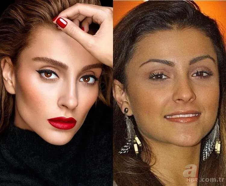 Ebru Yaşar’dan estetik itirafı: Kimse yüzüme bakmazdı 24