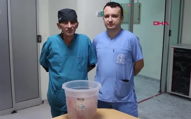 Karnından çıkan hayrete düşürdü! 10 kilo ağırlığında...