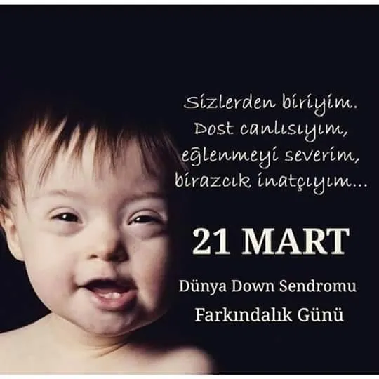 21 Mart Down Sendromu Günü sözleri, mesajları! Down sendromu nedir?