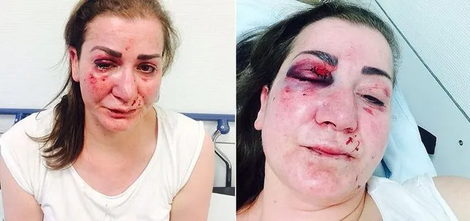 Almanya’da Türk kadına tramvayda saldırı